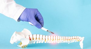 O que é Cifoplastia? - ITC Vertebral