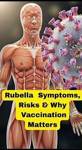 Rubella (German Measles): Symptoms, Risks & Prevention You Must Know @tgbid
