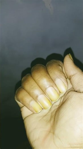 ,,,🥰🥰🥰🥰🥰🥰