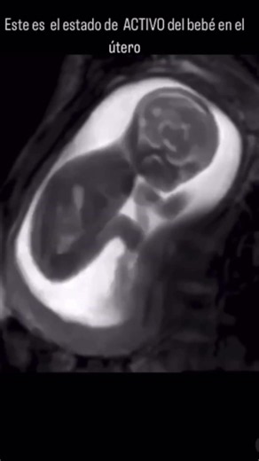 ¿Que hacen los bebés dentro de la barriga de mamá? ❤️