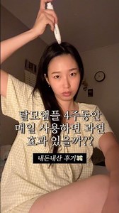 Will using a hair loss ampoule every day for 4 weeks really be effective? My own review,,💸