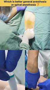 Which is better general anesthesia or spinal anesthesia ? #anesthesiologist #anesthesiology #anesthetist #anesthesialife #anaesthesia #doctor #mbbs #medical #NEET #fbreels | Medication Knowledge