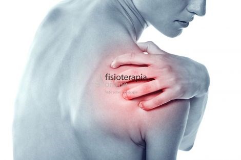 Todo sobre la lesión de SLAP (Superior Labrum Anterior to Posterior) del hombro