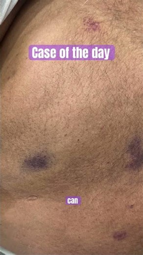 OH 🤯 #viralvideo #generalphysician #shortvideos #hospital #youtubeshorts #youtube #medicaleducation