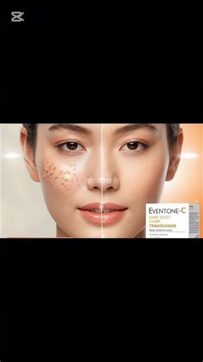 Eventone c cream for skin whitening #skincare #cream #pharmcist #trending #viral