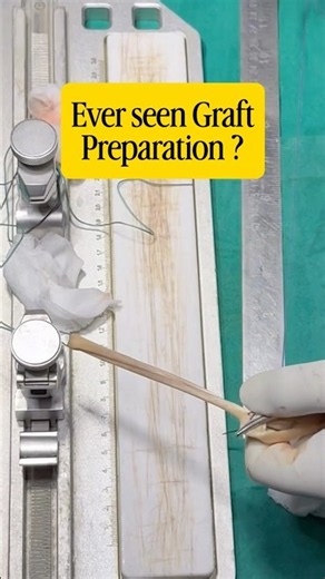 This is how we prepare graft for acl pcl reconstruction surgery! #drkunal #orthopaedics #sports