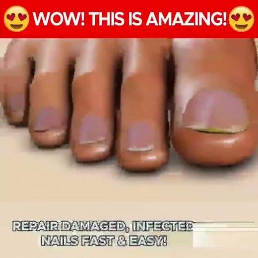 BRIGHT PENCIL ANTI FUNGUS INFECTION BIOLOGICAL REPAIR NAIL TREATMENT 3ml 一笔亮生物修护膜