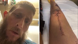 'Moonshiners' Josh Owens Talks Motorcycle Crash, Broken Neck, Back, Legs and Arm