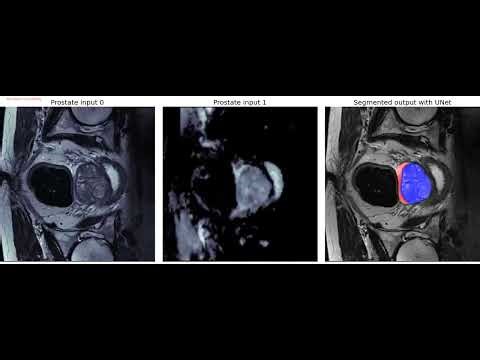 Prostate image segmentation | U-Net | python | Medical Segmentation | Decathlon dataset