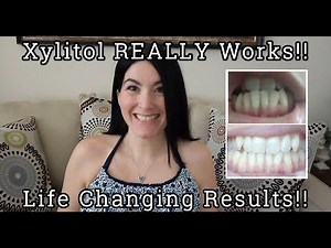 My 9 Month Xylitol Results: Teeth Remineralized/Gum Recession Reversed!