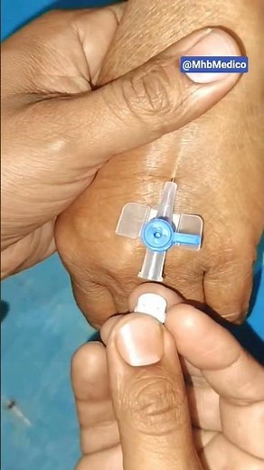 Successful IV Cannula Insertion Every Time 💯 | Easy Tips & Tricks #shorts #medicalshorts