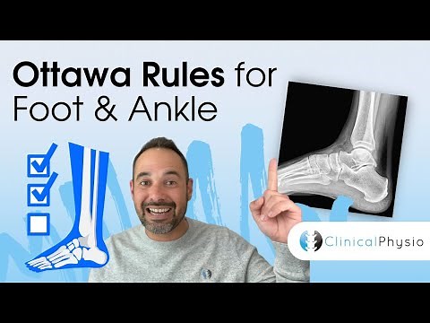 Ottawa Rules for Foot and Ankle | Expert Physio Explains