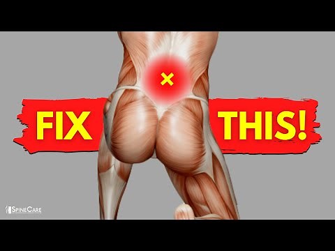 How to Fix Your Lower Back Pain | STEP-BY-STEP Guide