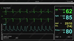 EKG Patient Heart Monitor Screen with Vital Signs
