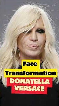 Donatella Versace Face Transformation: 34 Years of Style and Change