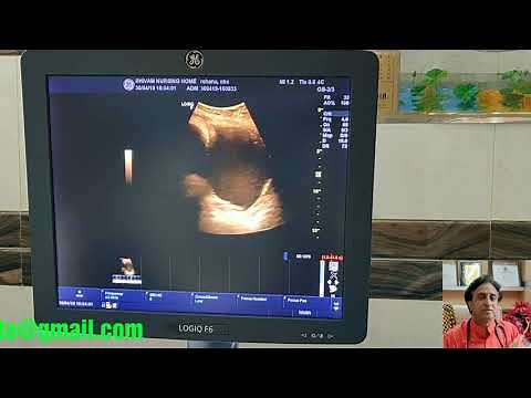 Color Doppler Ultrasound in Pregnancy , How to Perform?
