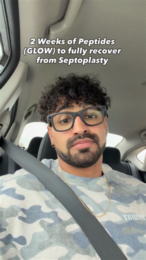 RAHUL MODI | Weightloss Coach on Instagram: "2 week recovery update after septoplasty and turbinate reduction. Breathing is insanely clear now. It took about a week and a half for my nose to really open up but once it did it was night and day. I was lifting heavy again 4 days post surgery and doing hard cardio by day 6. Never had any bleeding after surgery day and never needed pain meds. My surgeon told me recovery would likely be over 3 weeks so I was honestly surprised. The GLOW peptide stack 