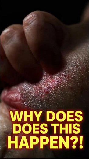 Why Do We Itch? #ScienceFacts #DidYouKnow