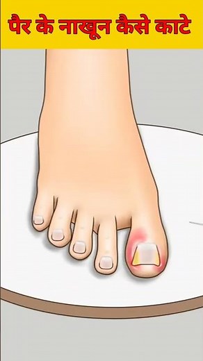 पैर के नाखून को काटने का तरीका | #shorts #viralshorts #youtubeshorts #shortsfeed