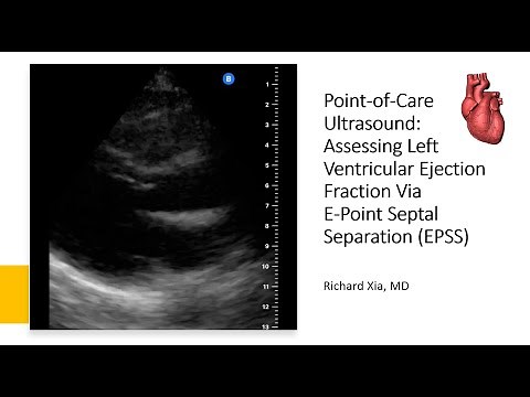 Point of Care Ultrasound (POCUS) - Assessing LVEF using E-Point Septal Separation (EPSS)