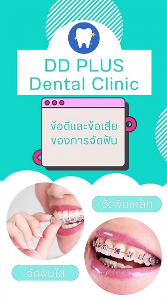 ข้อดี-ข้อเสีย การจัดฟันเหล็กกับจัดฟันใส 🥰🦷 #จัดฟันใส #จัดฟันเหล็ก #ทำฟันดีดีพลัส