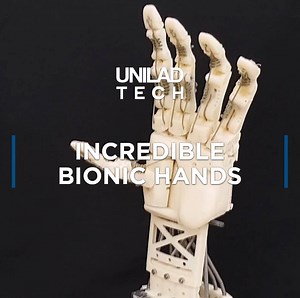 108K views · 1.2K reactions | These bionic hands are amazingly realistic and even have fingertip control  | UNILAD Tech | Facebook