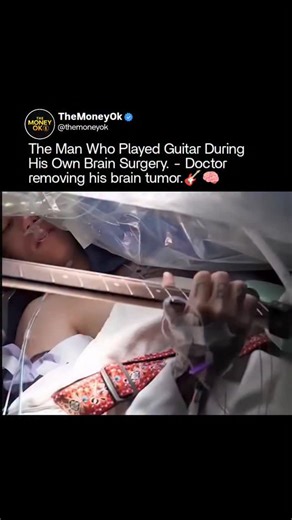 The Money Ok on Instagram: "🎸 Playing Guitar During Brain Surgery — sounds unreal, but it’s 100% real science in action. To make sure the surgery didn’t steal his music, doctors asked this patient to keep playing guitar while they removed a brain tumor. 🧠🎶 The tumor was sitting dangerously close to areas controlling movement, coordination, and creativity — the parts that make music feel alive. By keeping him awake and performing, surgeons could literally see which brain regions lit up with ev