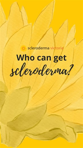 Who can get scleroderma? Scleroderma can affect anyone, but it’s 3–4 times more common in women than men, and usually appears between the ages 40-60. It’s rare in children, and not inherited. The cause isn’t fully known, but genetics, environment, and the immune system all play a role. The more we understand, the better we can support those living with scleroderma and push for earlier diagnosis and better care! #SclerodermaAwareness | Scleroderma Victoria