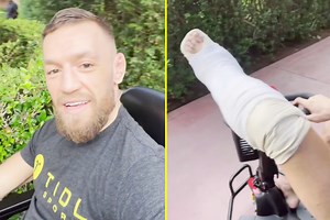 on the mend Conor McGregor reveals in Instagram post he had stress fractures in shin before Dustin Poirier fight and says he’s got an ‘unbreakable titanium leg like the Terminator’
