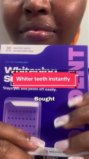 Best Teeth Whitening Techniques for 2026