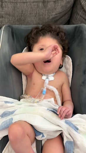 Just a normal day this morning, I know some of you been missing him. He’s fine and cuddly! ❤️ #ares #hairbear #wiggleworm #adorablebaby #trachbaby #trisomy9mosaic #specialneedsparenting | Hector Hernandez