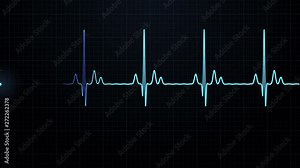Loopable: Blue EKG/ECG cardiogram oscilloscope monitor heartbeat line chart shows 60 BPM heart rate on black background with grid.