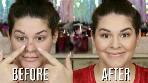 HOW TO COVER UP PIMPLES LIKE A PRO - FULL COVERAGE ACNE FOUNDATION ROUTINE