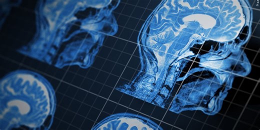 Michigan radiologist warns about ‘incidental findings’ in full body MRI scans