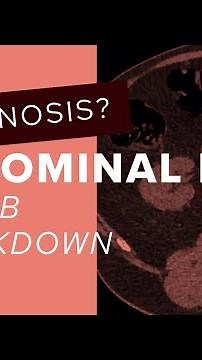 CT KUB breakdown: abdominal pain