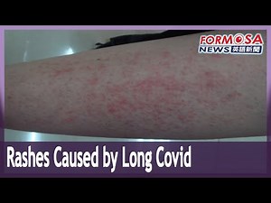Doctors warn that long COVID symptoms can include outbreaks of rashes and pustules