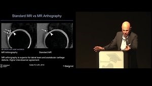 Routine MR Imaging of Cartilage and Labrum