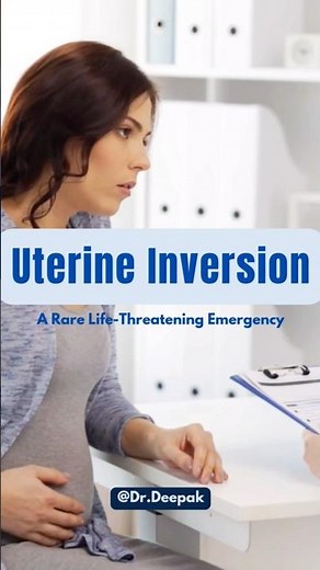 Uterine Inversion | Obstetric Emergency | #shortsfeed #obstetrics #shorts