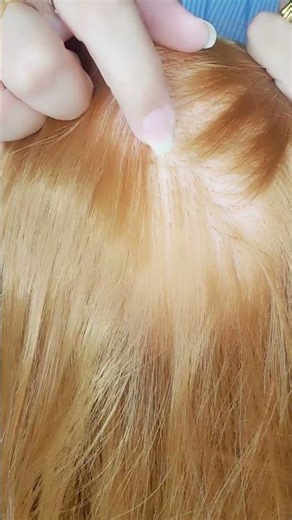 ASMR ⭐ fast & aggressive scalp scratching for tingle #asmr #scalpscratching #asmrsounds