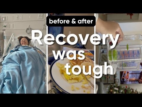 My Surgery Journey | Before & After + Recovery