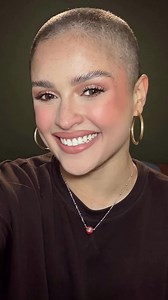 Why I Shaved My Head: Coping with Hair Loss and Support