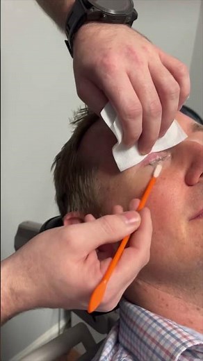 ZEST Treatment For Dry Eyes
