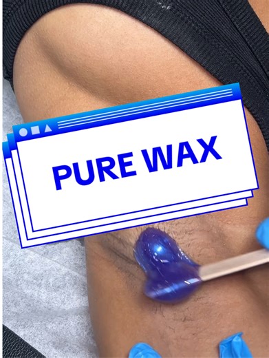 312K views · 5.3K reactions | Hyperhidrosis underarm wax using Pure wax by Wax-life This wax model said no tweezing, but I think we did great! #fyp #hyperhidrosis #waxing #underarmwax #waxlife #satisfying #esthetician #foryoupage #fblifestyle #reelsvideo | Waxing Queen | Facebook
