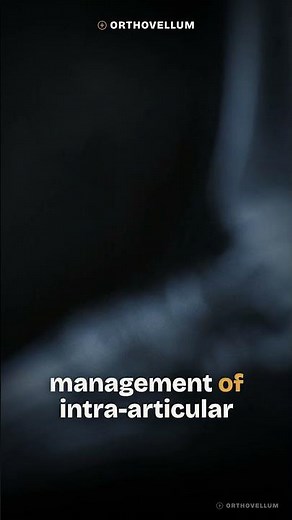 Pilon Fractures Masterclass: Distal Tibia Intra-Articular Injury & Soft Tissue Management