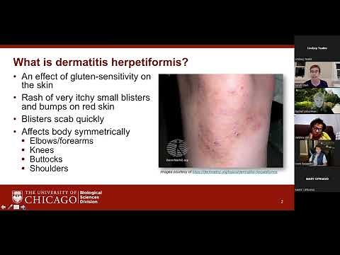 Dinner with the Doctor - Dermatitis Herpetiformis