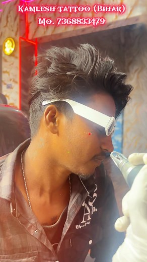 || Tattoo removal 😥🥹 Kamlesh tattoo