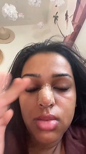 Is it possible to change the shape of your nose yourself without surgery? More and more people are giving nose taping a try | PinkNews