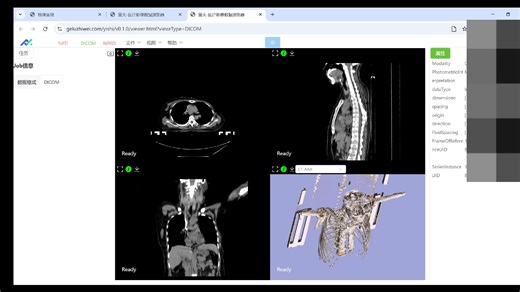 医学影像NRRD/NifTI/DICOM可视化工具