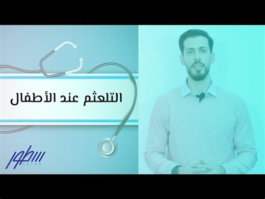 التلعثم عند الأطفال