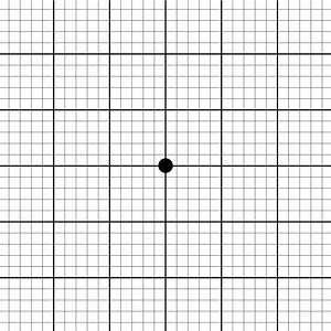 La DMLA (Dégénérescence Maculaire Liée à l’Âge) est une maladie de la rétine qui touche les personnes de plus de 50 ans. 😞 Faites le test ou montrez-le à vos proches. 〰〰 Si vous percevez les lignes droites comme déformées ou ondulées, il s'agit d'un signe évocateur de la DMLA. En cas de doute, 👉consultez votre ophtalmologiste. | CLIN d'OEIL Fort de France - SYL'Optic sarl